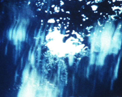 �q�ǂ������̎��[�𖄂߂ɂ���